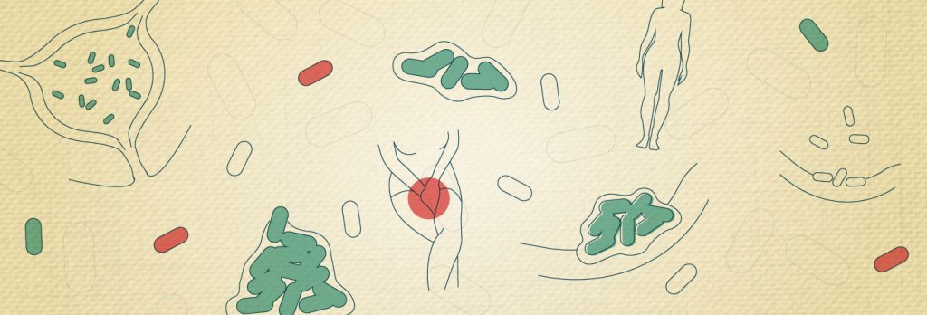 Chronic Urinary Tract Infection Vs. Recurrent UTI