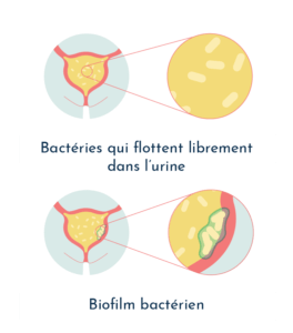 Formation d'un biofilm bactérien pathogènes dans la vessie