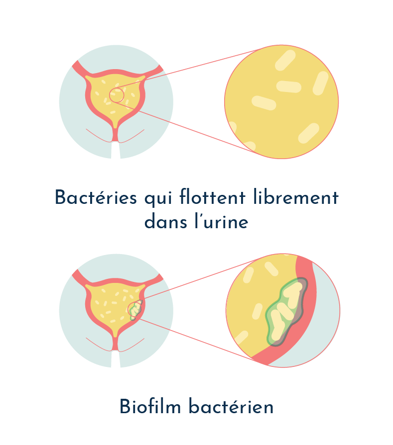 Formation d'un biofilm bactérien pathogènes dans la vessie
