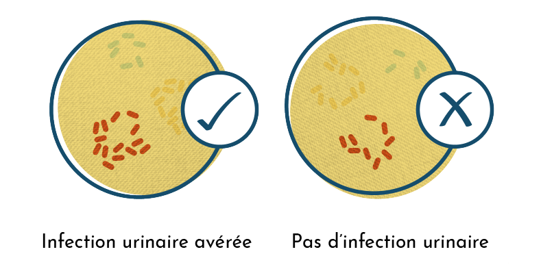 Résultat culture négative vs positive