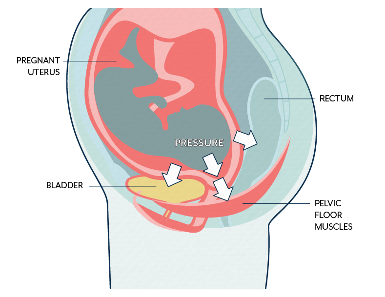 Pregnancy, pelvic floor muscles and urinary incontinence