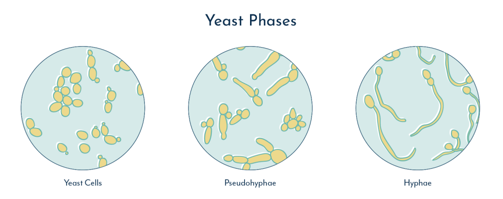 Yeast hyphae, recurrent vaginal yeast infection and lower urinary tract symptoms