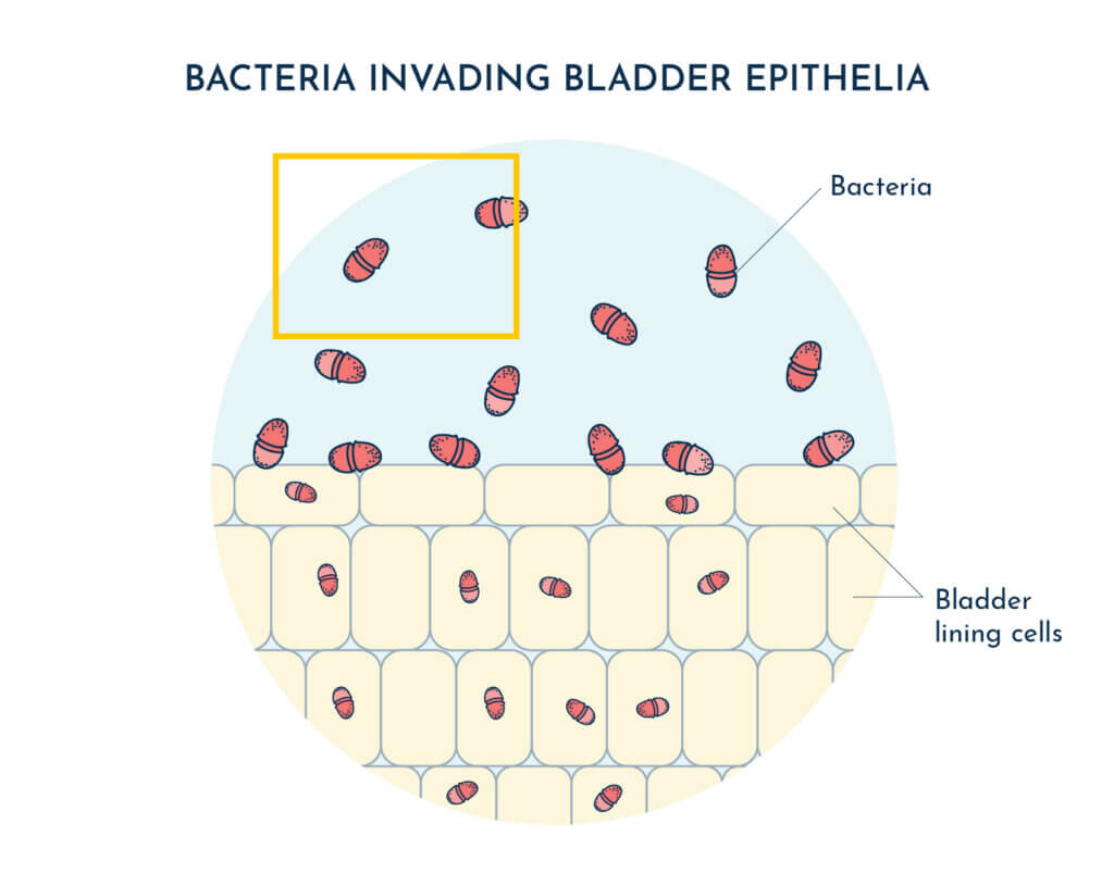 Bacteria inside bladder wall cells Bacteria invading bladder epithelia