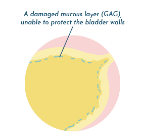 A damaged mucous layer (GAG)